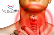 Медицинский центр Ангио Лайн предлагает углубленное УЗИ щитовидной железы Медицинский центр Ангио Лайн предлагает углубленное УЗИ щитовидной железы